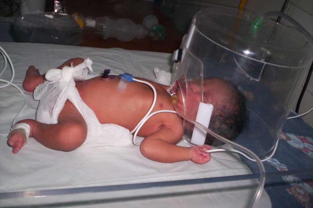 Tragedy Strikes Indian Hospital, Ten Infants Killed in Neonatal Fire
