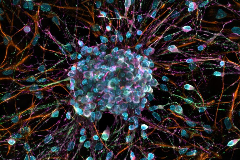 Stomach stretch receptors signal fullness through brainstem neural network