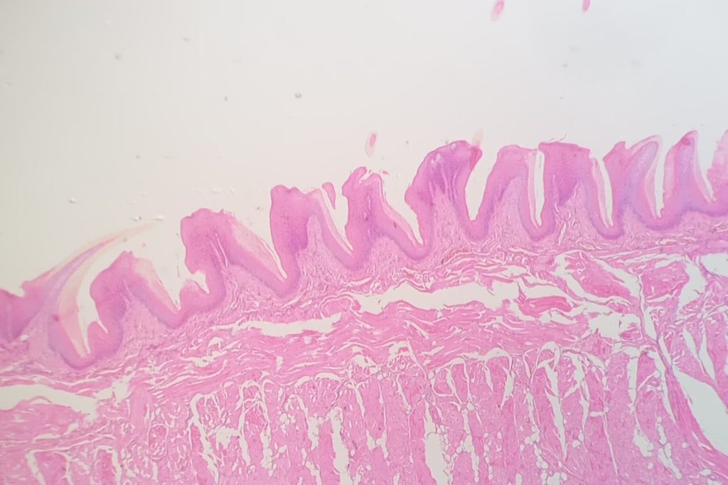GATA6 Gene Acts as Molecular Identity Keeper in Intestinal Cells