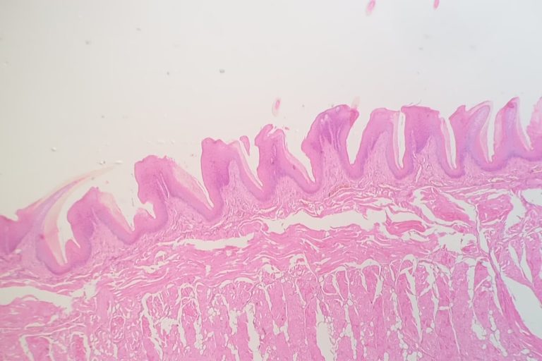 GATA6 Gene Acts as Molecular ‘Identity Keeper’ in Intestinal Cells